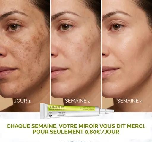Ecladerm Rétinal Shot — L’alternative n°1 au Botox