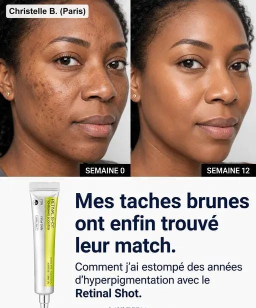 Ecladerm Rétinal Shot — L’alternative n°1 au Botox
