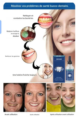 Sérum Dentaire Repair+ – Prenez soin de votre sourire au quotidien