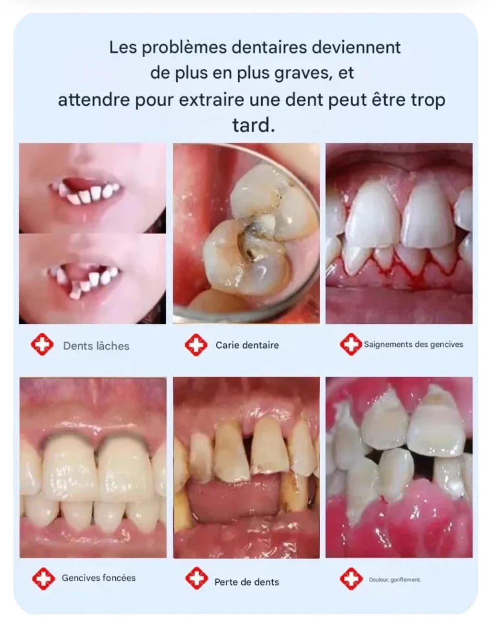 Sérum Dentaire Repair+ – Prenez soin de votre sourire au quotidien
